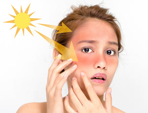 ¿El sol, nuestro mejor amigo o enemigo? CosmeticsTenerife.es