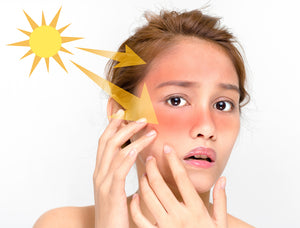 The sun, our best friend or enemy? CosmeticsTenerife.es